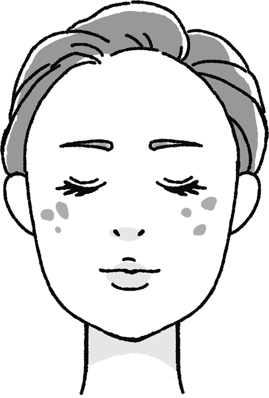老人性色素斑のある女性の顔のイラスト