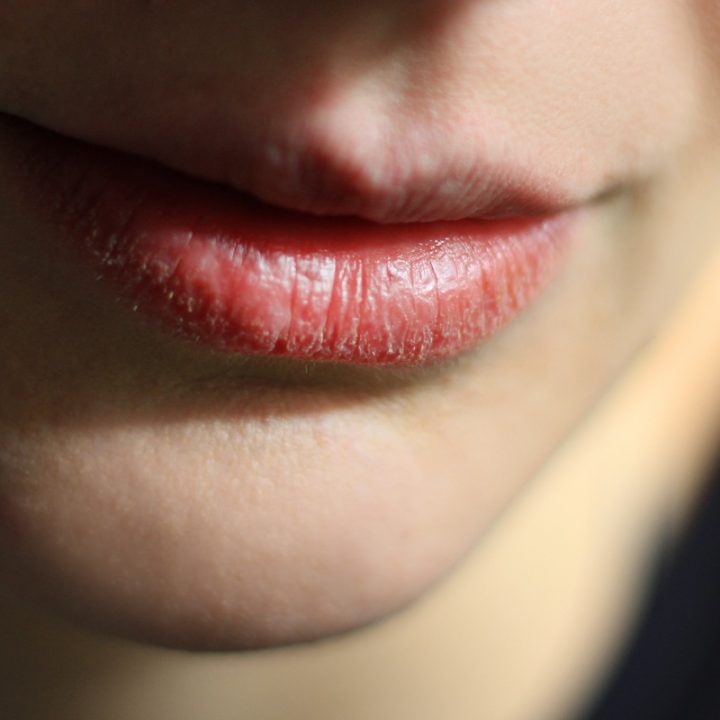 唇が荒れる原因と対策 リップクリームの正しい選び方や血色がよくなるリップマッサージも紹介 1 1 8760 By Postseven