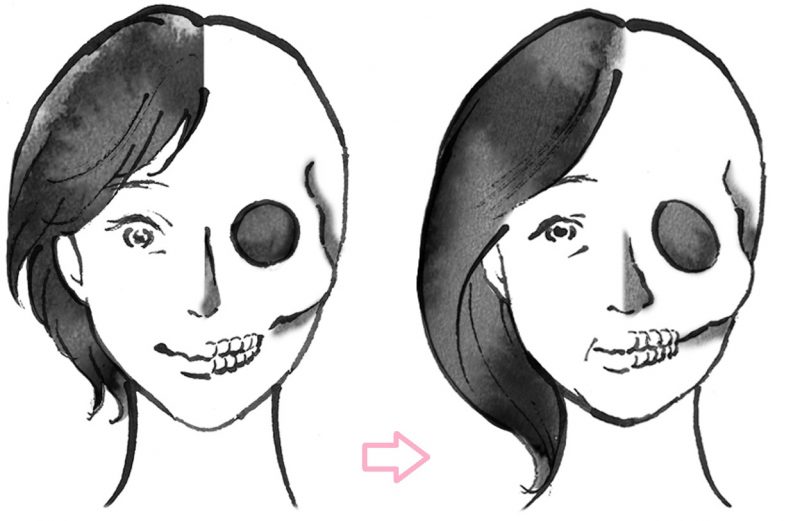 左が若いとき、右が更年期の骨の様子。骨密度の低下がたるみの原因に