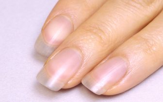 爪を健康に保つケア方法｜爪先の白い部分は2mmは残す、保湿には植物性オイルを