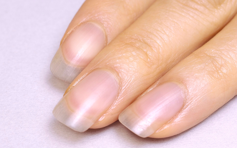 爪を健康に保つケア方法 爪先の白い部分は2mmは残す 保湿には植物性オイルを 1 1 8760 By Postseven
