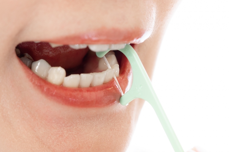 歯ブラシ以外の歯間ブラシやフロスなどの歯間清掃具が必須（Ph／photoAC）